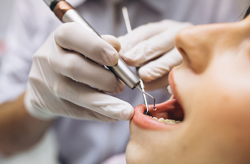How to Choose the Right Toothpaste for Your Oral Health Needs